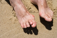 Conditions Associated With Hammertoe